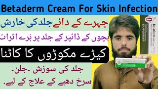 Betaderm N Cream  Neomycine  Betamehasone  Treatment Of Skin Infecions EczemaRashesDermatitis [upl. by Simonsen146]