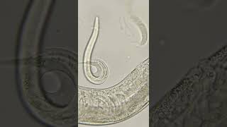 Phylum Aschelminthes Nematoda Roundworms [upl. by Ahsilra533]