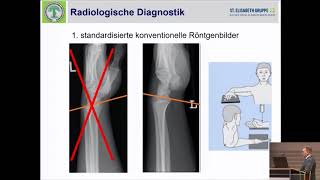 1011  Behandlungsalgorithmus der distalen Radiusfraktur [upl. by Seabrook]