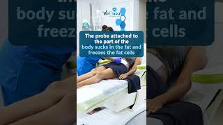 Cryolipolysis treatment at VeCura Wellness Clinic [upl. by Cayser]