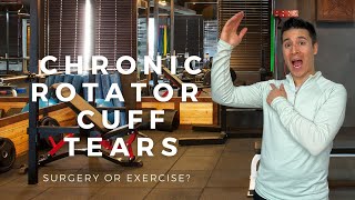 Treating Chronic Rotator Cuff Tears  Surgery or Exercise [upl. by Yendirb]