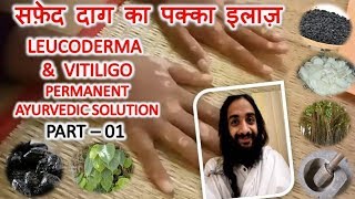 सफ़ेद दाग का पक्का इलाज़1 LEUCODERMA AND VITILIGO PERMANENT AYURVEDIC SOLUTION  PART  01 [upl. by Ackerman575]