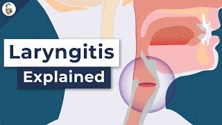 Why Do You Lose Your Voice  Laryngitis Explained [upl. by Normi]