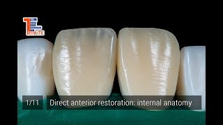 Direct anterior restoration internal anatomy [upl. by Adnarrim]