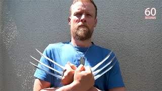 Meet The Irish Man Who Got Wolverine Claw Implants In Turkey [upl. by Sweet]