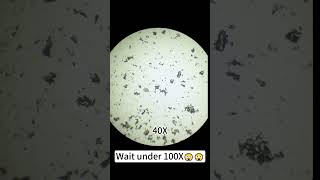 Jelly zoomed in 400X is seriously so coolunderthemicroscope microscope [upl. by Matteo532]