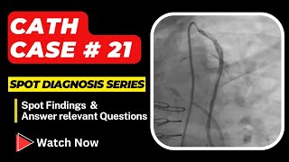 Cardiac Cath Case 21 Spot Diagnosis Series  Interventional Cardiology heart [upl. by Ehcor94]