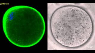 Actin flow and cytoplasmic streaming in MII oocyte [upl. by Ethbun667]