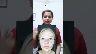 ACNE SKINCARE ROUTINE😱follow for more skincare darkspots annetreatment acne beauty [upl. by Bivins]