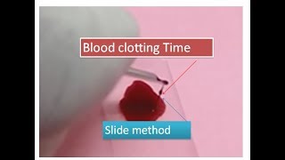 Blood clotting time without use of filter paper  slide method [upl. by Nnahteb]