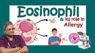 ইওসিনোফিল কি Why Eosinophils are SO Important for Your Body Role of eosinophils in allergy [upl. by Melvena368]