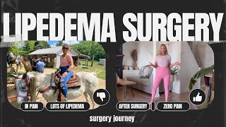 Lipedema surgery [upl. by Yerrok]