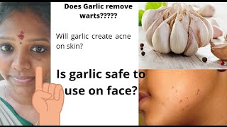 Does Garlic remove warts  story time  how to treat skin burn becos of garlic [upl. by Anoli585]