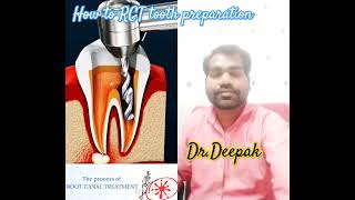 How to RCT tooth preparation rootcanal dentalanatomy cleaning dentist 🥰 [upl. by Lledraw]