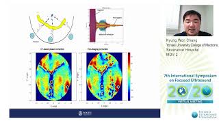 Kyung Won Chang  Feasibility amp Efficacy of MRgFUS with Autofocusing Echo Imaging [upl. by Stag]