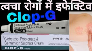 CLOPG Cream Uses in Hindi  Clobetasol Propionate amp Gentamicin Sulphate Cream [upl. by Normac]