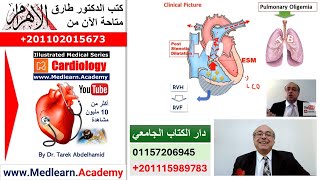 Pulmonary Stenosis cme internalmedicine ecg usmle medical محاضراتباطنة [upl. by Yenahs]