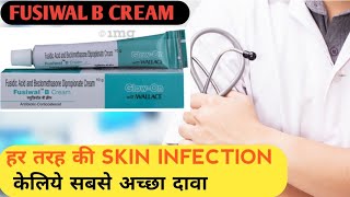 fusiwal b cream uses in hindi  beclomethasone and fusidic acid uses  fusidic acid cream ip 2 ww [upl. by Pierre]