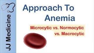 Anemia  Microcytic vs Normocytic vs Macrocytic [upl. by Mallis]