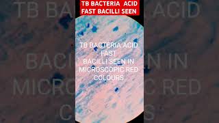 Acid fast bacilli T B bacteriashortvideobmlt dmlt medical mlt mbbs [upl. by Blackington]