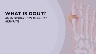 How to Overcome Gout Naturally  Dr Josh Axe [upl. by Allissa]