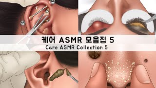 ASMR 케어 애니메이션 모음집5  귀지 피어싱 코피지 다래끼  CARE ANIMATION COLLECTION5  Earwax Piercing sebum stye [upl. by Yevad248]