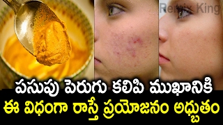 Amazing Beauty Benefits of Turmeric and Curd Mix  పెరుగు పసుపు కలిపి ముఖానికి రాస్తే  Remix King [upl. by Dnaleel]