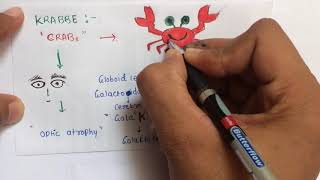 Lysosomal storage diseases mnemonic  USMLE  NEETPG  AIIMS [upl. by Nivrehs]