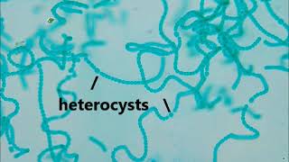 anabaena cyanobacteria Brightfield microscopy [upl. by Shara202]