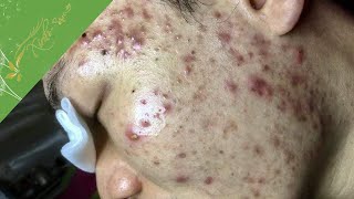 Most Satisfying And Attractive Video With Xinh Spa New 2022 20 [upl. by Yi84]