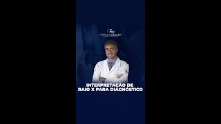 Interpretação de raio X para diagnóstico [upl. by Giulio347]