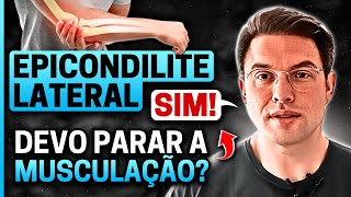 Quem tem EPICONDILITE LATERAL pode fazer MUSCULAÇÃO  Muzy Explica [upl. by Eigna]