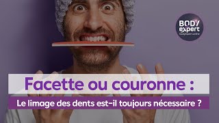 SOINS DENTAIRES  🦷 Facettecouronne  Le limage des dents estil toujours nécessaire   BODYEXPERT [upl. by Skricki194]