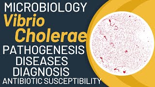 Vibrio cholerae cholera  Vibrio cholerae microbiology  Pathogenesis lab diagnosis [upl. by Elocel]