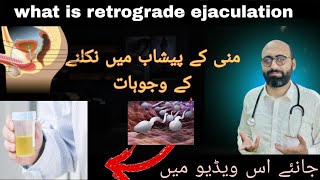 Understanding Retrograde EjaculationCauses and SymptomsManaging Retrograde Ejaculation [upl. by Meelak43]