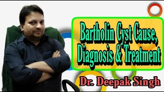 Bartholin Cyst Cause Diagnosis and Treatments  Bartholin Gland Disease  Dr Deepak Singh MSC [upl. by Gavra737]