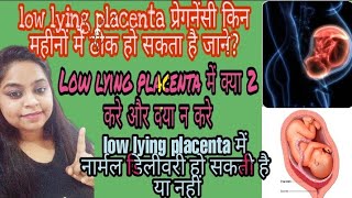 Low lying placenta में क्या 2 करे और क्या न करेlow lying placenta in hindi [upl. by Eynaffit]