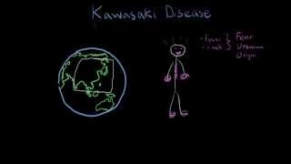 What Is Kawasaki Disease [upl. by Namaan7]