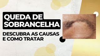 Queda de Sobrancelha  Descubra as causas e como tratar [upl. by Nimsay300]