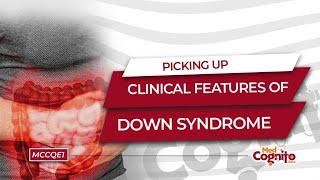 Picking Up Clinical Features of Down Syndrome  MCCQE1 [upl. by Boyden]