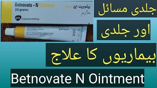 Betnovate n ointment uses and DosageBetnovate n ointment review in urdu hindi [upl. by Ociredef]