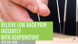 Relieve Low Back Pain Instantly with Acupuncture [upl. by Aret]