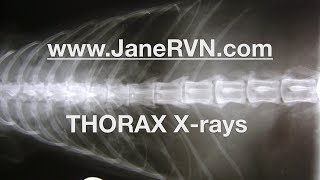 planetrvn OSCEtips imaging thorax [upl. by Aleece]