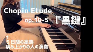 ５日間の高熱。からの黒鍵｜音大卒のママ｜Chopin etude op105 [upl. by Llebana960]