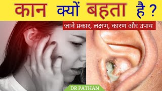 कान बहना क्या है l कान का बहना  Ear Discharge  कान बहने के प्रकार लक्षण कारण दवा और इलाज l [upl. by Argus]