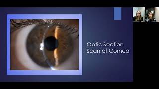 Lecture Using the Slit Lamp Microscope to Visualize the Ocular Structures [upl. by Aihsakal]