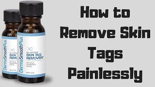 How to Remove Skin Tags Painlessly [upl. by Ludeman722]