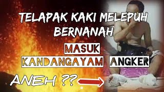 TELAPAK KAKI MELEPUH amp BERNANAH SECARA MENDADAK ❗ [upl. by Edgard]