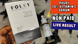 Foley 10 Vitamin C Serum  Foley 10 Vitamin C Serum  Review  Foley 10 vitamin c face serum 2024 [upl. by Anaicul210]