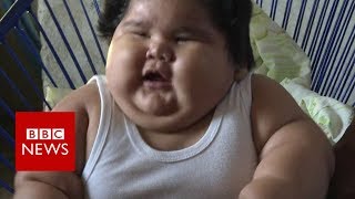 Why is this baby so overweight  BBC News [upl. by Emoraj]